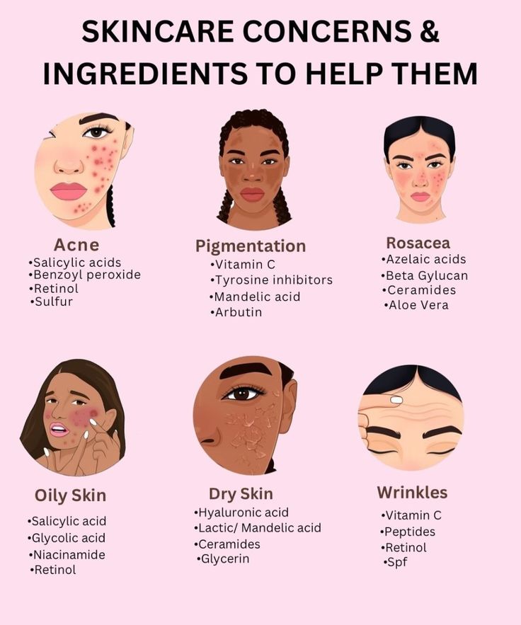 skincare concerns & ingredients to help them